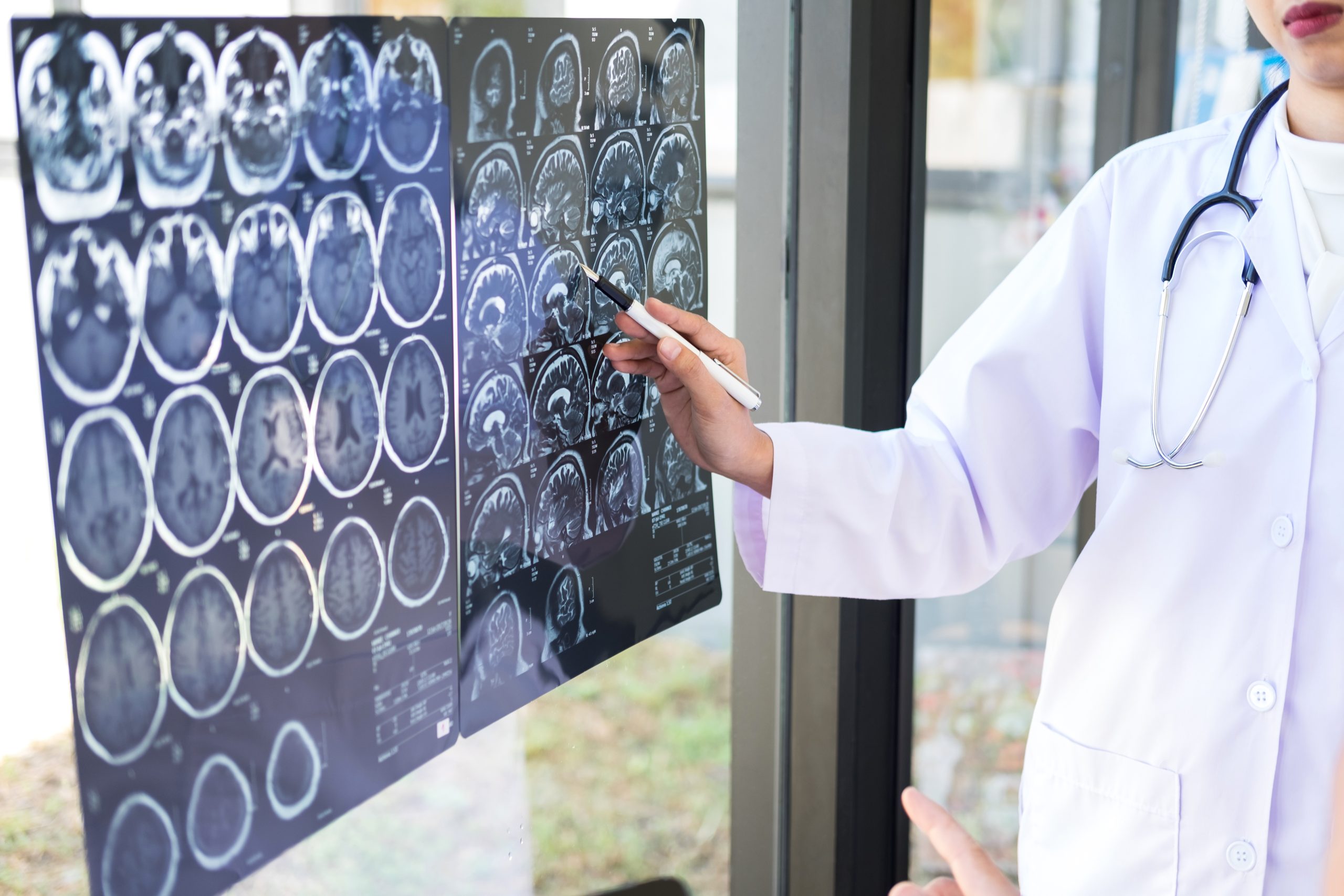 Neurochirurgie
