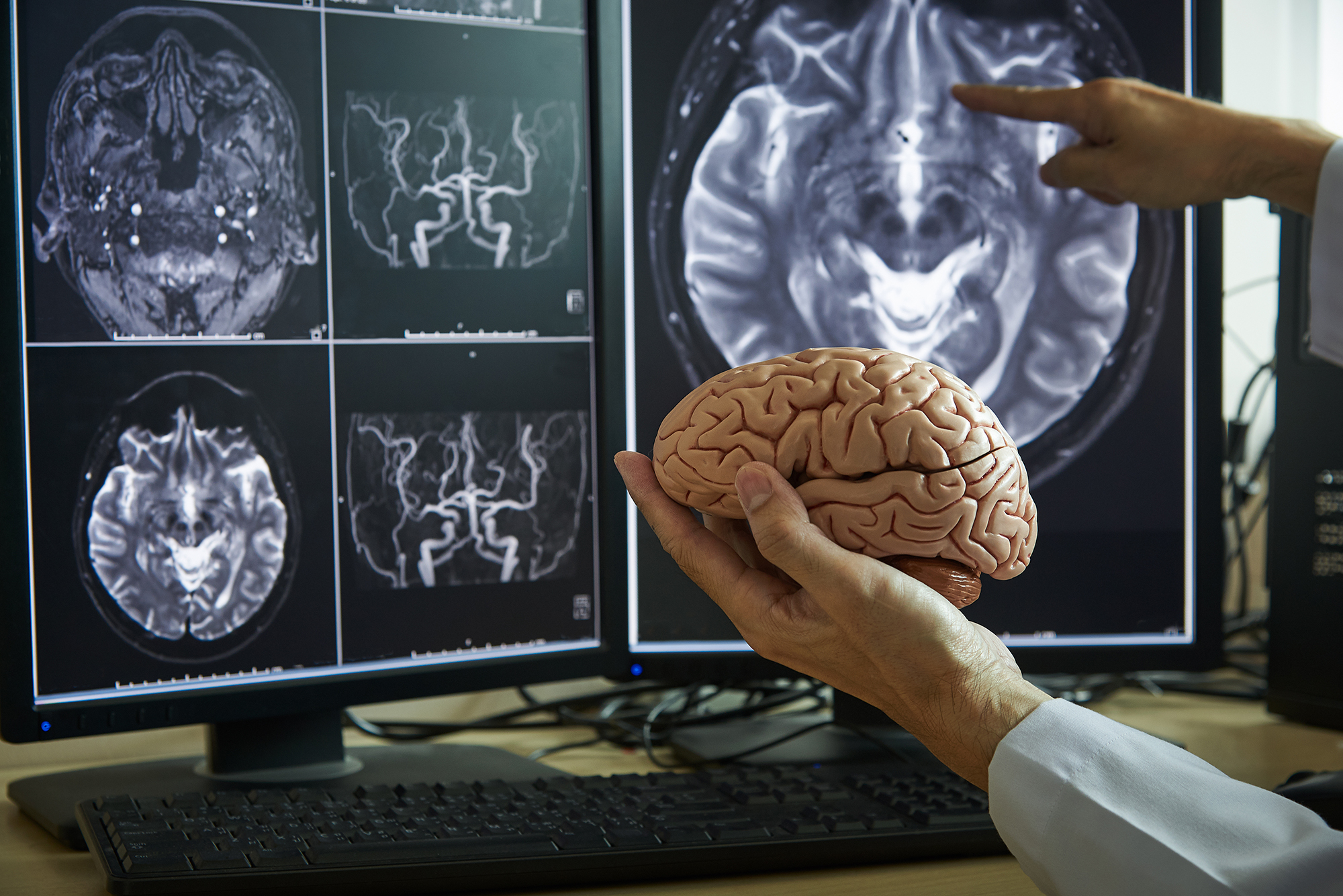 Neurochirurgie